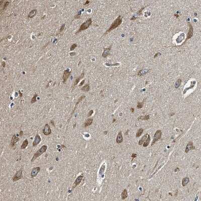 Immunohistochemistry-Paraffin: Mind Bomb 1/MIB1 Antibody [NBP1-85210]