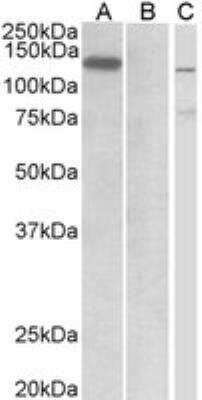 Western Blot: Mind Bomb 1/MIB1 Antibody [NBP3-11304]