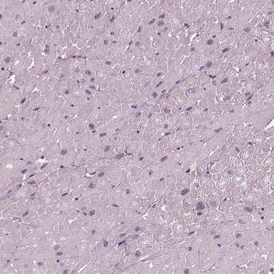 Immunohistochemistry-Paraffin: Mind Bomb 2/MIB2 Antibody [NBP2-57751]