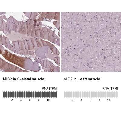 Immunohistochemistry-Paraffin: Mind Bomb 2/MIB2 Antibody [NBP2-57751]