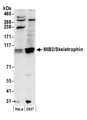 Western Blot: Mind Bomb 2/MIB2 Antibody [NB100-68224]