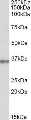 Western Blot: Mindin/Spondin-2 Antibody [NBP1-52031]