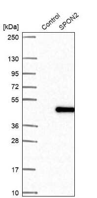 Western Blot: Mindin/Spondin-2 Antibody [NBP2-30500]