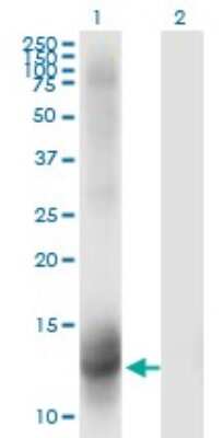 Western Blot: Mineralocorticoid R/NR3C2 Antibody (2B5) [H00004306-M01]