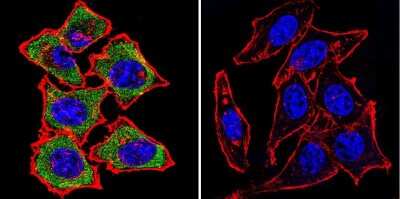 Immunocytochemistry/ Immunofluorescence: Mineralocorticoid R/NR3C2 Antibody (H10E4C9F) - BSA Free [NB300-562]