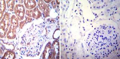 Immunohistochemistry-Paraffin: Mineralocorticoid R/NR3C2 Antibody (H10E4C9F) - BSA Free [NB300-562]