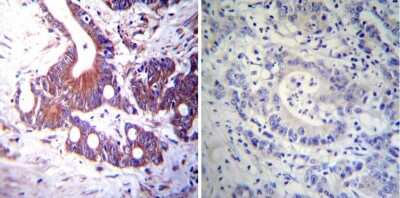 Immunohistochemistry-Paraffin: Mineralocorticoid R/NR3C2 Antibody (H10E4C9F) - BSA Free [NB300-562]