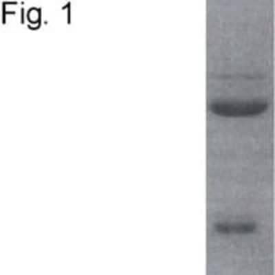 Western Blot: Mineralocorticoid R/NR3C2 Antibody (H10E4C9F)BSA Free [NB300-562]