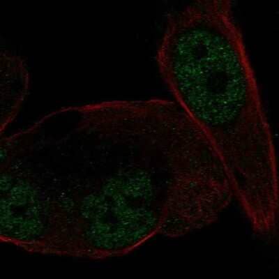 Immunocytochemistry/ Immunofluorescence: Mineralocorticoid R/NR3C2 Antibody [NBP2-57853]