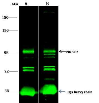 Immunoprecipitation: Mineralocorticoid R/NR3C2 Antibody [NBP2-99010]