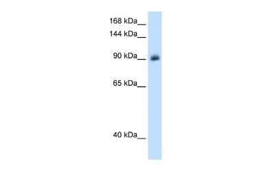 Western Blot: Mineralocorticoid R/NR3C2 Antibody [NBP1-70640]