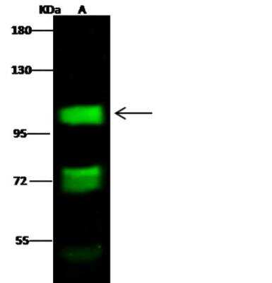 Western Blot: Mineralocorticoid R/NR3C2 Antibody [NBP2-99010]