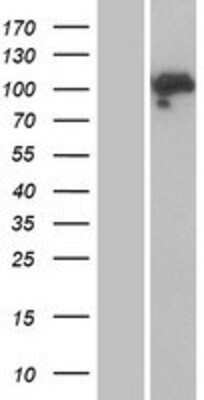 Western Blot: Mineralocorticoid R/NR3C2 Overexpression Lysate [NBP2-10715]