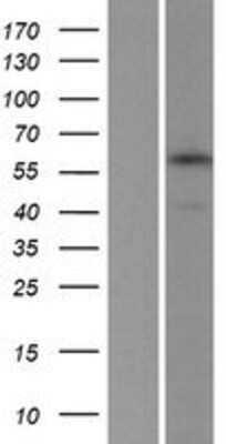 Western Blot: APBA3/Mint-3 Overexpression Lysate [NBP2-10542]