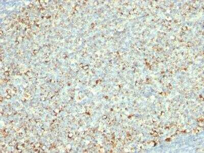 Immunohistochemistry-Paraffin: Mitochondria Antibody (AE-1) - IHC-Prediluted [NBP2-48282]
