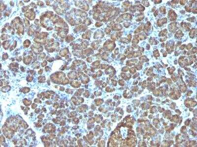 Immunohistochemistry-Paraffin: Mitochondria Antibody (AE-1) - IHC-Prediluted [NBP2-48282]