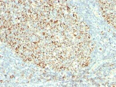 Immunohistochemistry-Paraffin: Mitochondria Antibody (MTC02) [NBP2-32982]