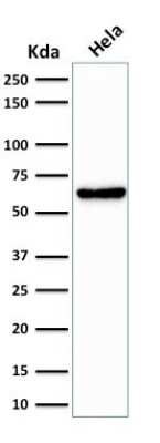 Western Blot: Mitochondria Antibody (SPM198) [NBP2-32981]