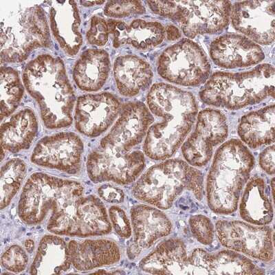 Immunohistochemistry-Paraffin: Mitochondrial Ribosomal Protein S18C Antibody [NBP2-14807]