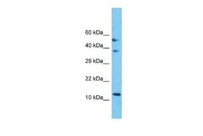 Western Blot: Mitochondrial Ribosomal Protein S18C Antibody [NBP2-83210]