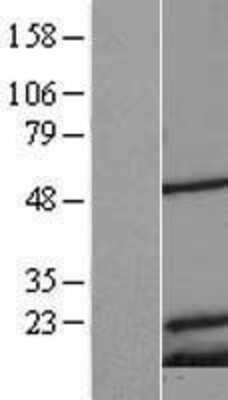 Western Blot: Mitochondrial Ribosomal Protein S18C Overexpression Lysate [NBL1-13290]