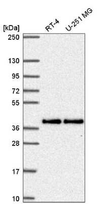 Western Blot: Mitochondrial fission regulator 1 Antibody [NBP2-55309]