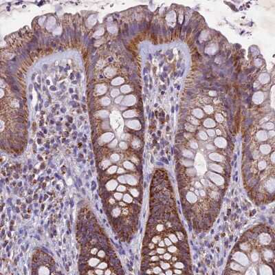Immunohistochemistry-Paraffin: Mitochondrial-processing peptidase subunit beta Antibody [NBP1-92120]