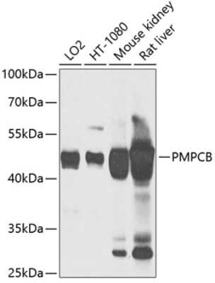 Western Blot: Mitochondrial-processing peptidase subunit beta AntibodyBSA Free [NBP3-03227]