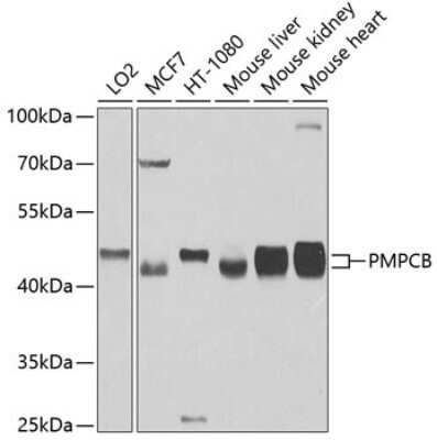 Western Blot: Mitochondrial-processing peptidase subunit beta AntibodyBSA Free [NBP3-03228]