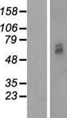 Western Blot: Mitochondrial-processing peptidase subunit beta Overexpression Lysate [NBP2-10580]