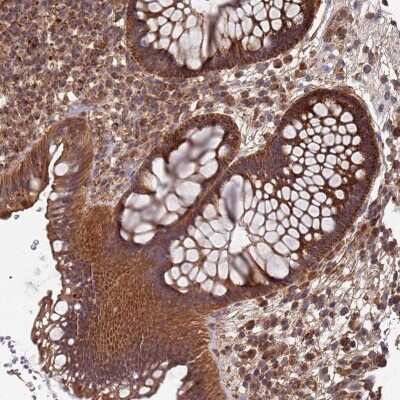 Immunohistochemistry-Paraffin: Mitochondrial ribonuclease P protein 3 Antibody [NBP2-13619]