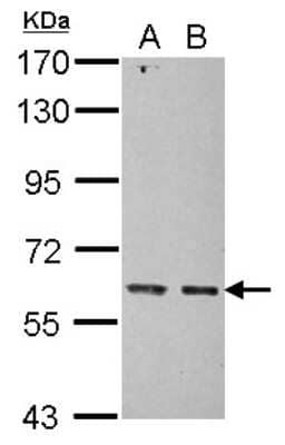 Western Blot: Mitochondrial ribonuclease P protein 3 Antibody [NBP2-17295]