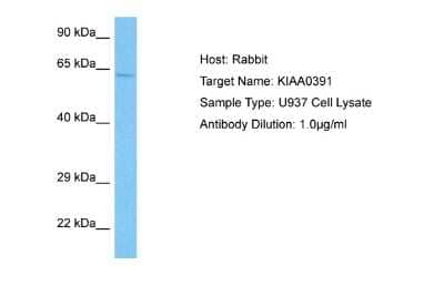 Western Blot: Mitochondrial ribonuclease P protein 3 Antibody [NBP2-85290]