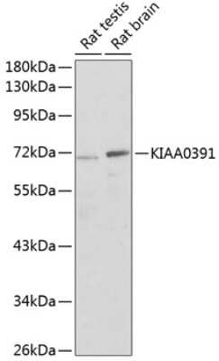 Western Blot: Mitochondrial ribonuclease P protein 3 AntibodyBSA Free [NBP3-03673]