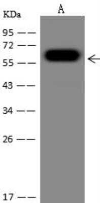 Western Blot: Mitochondrial ribonuclease P protein 3 Antibody [NBP3-12679]