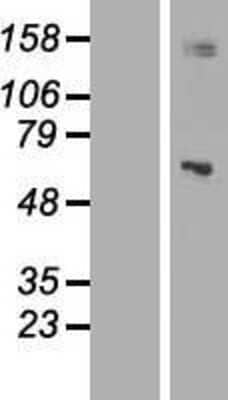 Western Blot: Mitochondrial ribonuclease P protein 3 Overexpression Lysate [NBL1-12244]