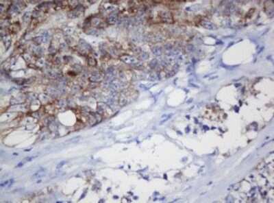 Immunohistochemistry: Mitochondrial ribosomal protein L11 Antibody (OTI1E5) [NBP2-45836]