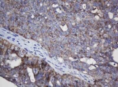 Immunohistochemistry: Mitochondrial ribosomal protein L11 Antibody (OTI1E5) [NBP2-45836]