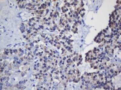 Immunohistochemistry: Mitochondrial ribosomal protein L11 Antibody (OTI1E5) [NBP2-45836]