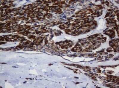 Immunohistochemistry: Mitochondrial ribosomal protein L11 Antibody (OTI1E5) [NBP2-45836]