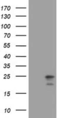 Western Blot: Mitochondrial ribosomal protein L11 Antibody (OTI1E5) [NBP2-45836]