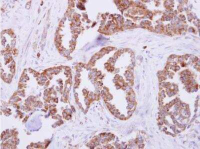 Immunohistochemistry-Paraffin: Mitochondrial ribosomal protein L11 Antibody [NBP2-17296]