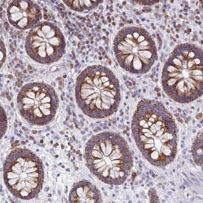 Immunohistochemistry-Paraffin: Mitochondrial ribosomal protein L11 Antibody [NBP2-33844]