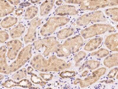 Immunohistochemistry-Paraffin: Mitochondrial ribosomal protein L11 Antibody [NBP3-06019]