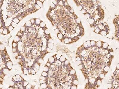 Immunohistochemistry-Paraffin: Mitochondrial ribosomal protein L11 Antibody [NBP3-06019]
