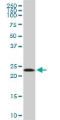 Western Blot: Mitochondrial ribosomal protein L11 Antibody [H00065003-B01P]