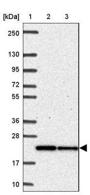 Western Blot: Mitochondrial ribosomal protein L11 Antibody [NBP2-33844]