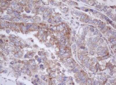 Immunohistochemistry: Mitocondrial Translational Initiation Factor 3 Antibody (OTI4B6) [NBP2-46034]