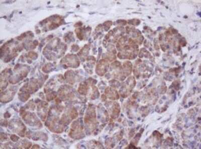 Immunohistochemistry: Mitocondrial Translational Initiation Factor 3 Antibody (OTI4B6) [NBP2-46034]