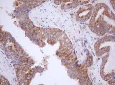 Immunohistochemistry: Mitocondrial Translational Initiation Factor 3 Antibody (OTI4B6) [NBP2-46034]